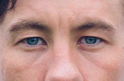 Barry Keoghan eye color