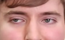 Mr Beast eye color